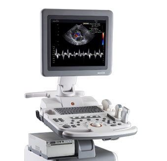 三星麥迪遜Sonovet R5超聲