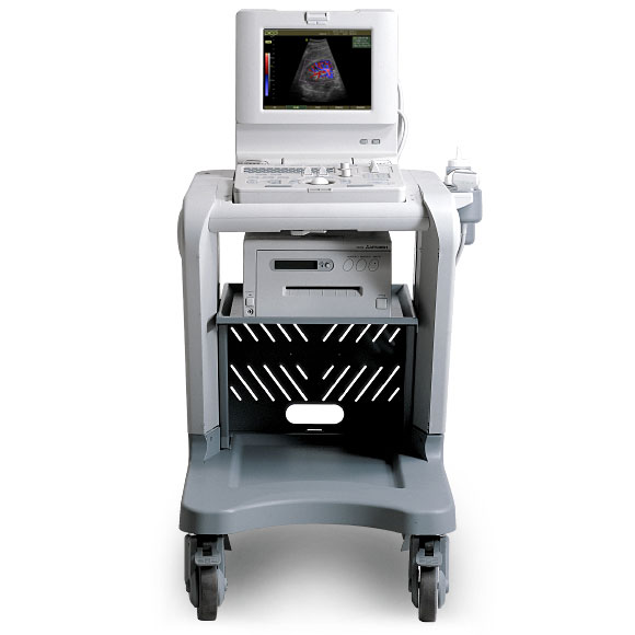 三星麥迪遜SONOACE PICO 全功能便攜式數字彩超