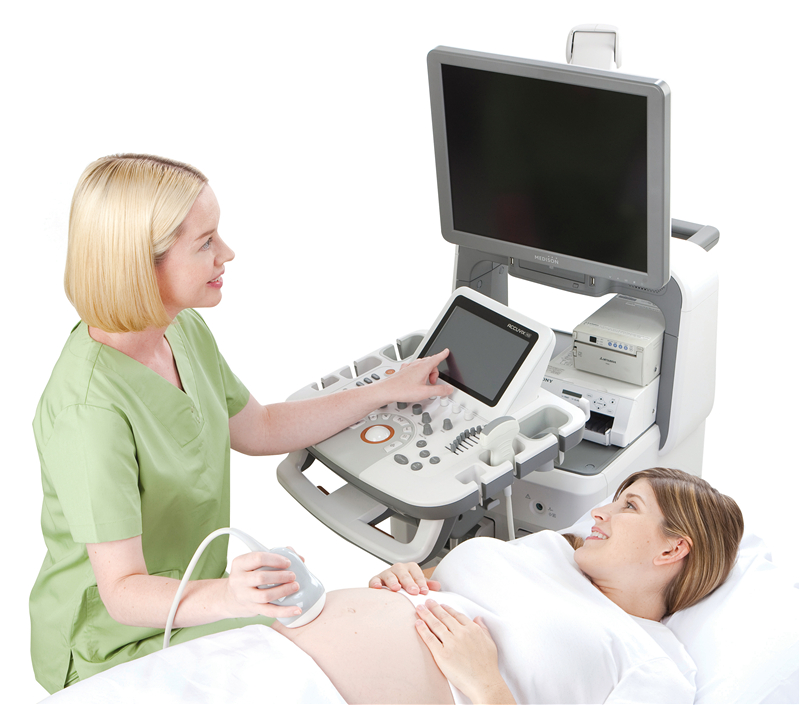 三星麥迪遜Accuvix XG超聲