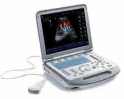 M5 便攜式彩色多普勒超聲系統
