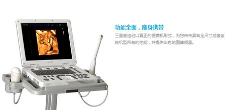 三星麥迪遜MySono U5便攜式超聲診斷儀