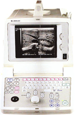 EG LOGIQ 50高檔便攜式B超