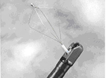 電子十二指腸鏡