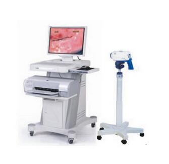 飛利浦金科威電子陰道鏡SLC-1000B