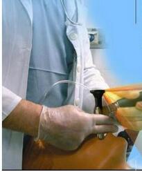 可視喉鏡 Truview EVO2