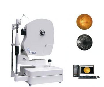 DFE-53眼底照相機