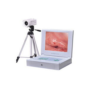 便攜電子陰道鏡 LC-9100A