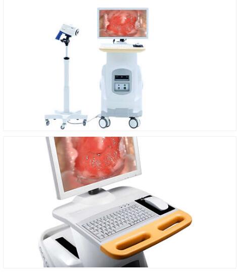 飛利浦SLC-2000B電子陰道鏡數字成像系統