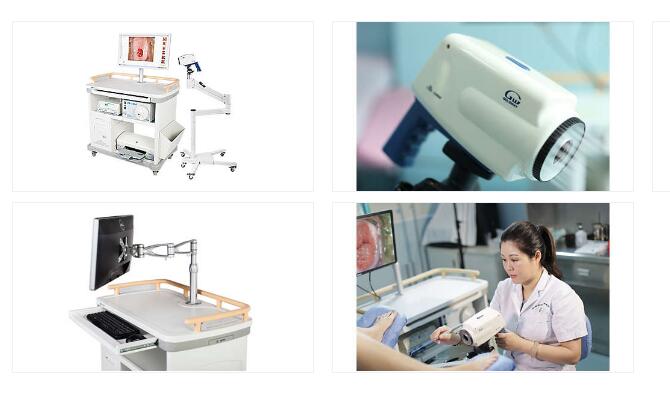 飛利浦SLC-3000 電子陰道鏡數字成像系統