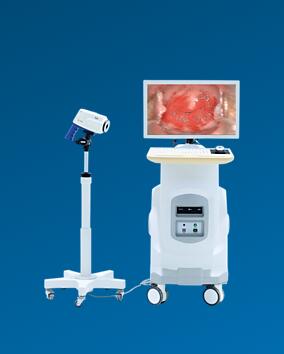 飛利浦新一代SLC-2000B電子陰道鏡數字成像系統