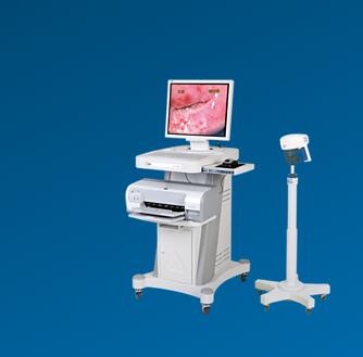 飛利浦新一代SLC-1000B電子陰道鏡數字成像系統