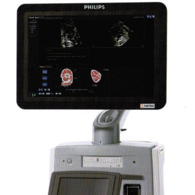 飛利浦超聲診斷系統IU ELITE