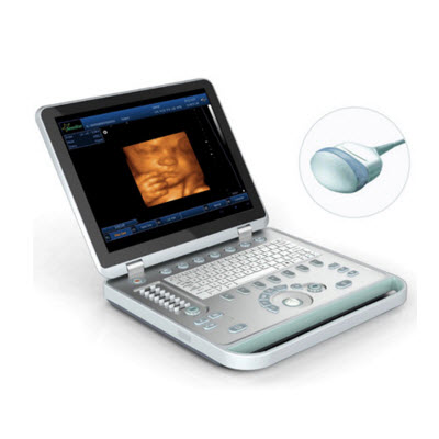 筆記本式4D(四維)B超 SS-10Plus