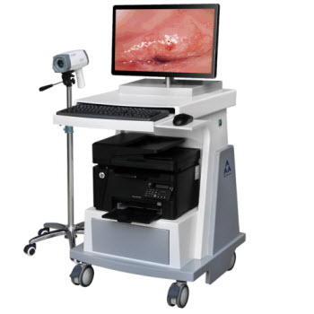 RCZ-3002型數碼電子陰道鏡(高清A版)