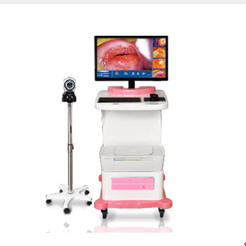 TR6000C數碼電子陰道鏡【標準型】