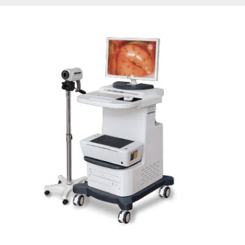 TR6000C數碼電子陰道鏡【豪華單屏型】