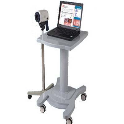 數碼電子陰道鏡(便攜式) KY-130