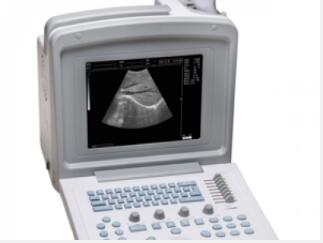 威爾德wed-180便攜式全數(shù)字超聲診斷系統(tǒng)