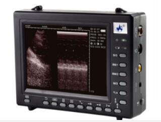 威爾德wed-2000掌上全數(shù)字超聲診斷系統(tǒng)