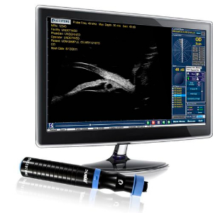 UBM PLUS GUARDED.jpg UBM PLUS GUARDED.jpg