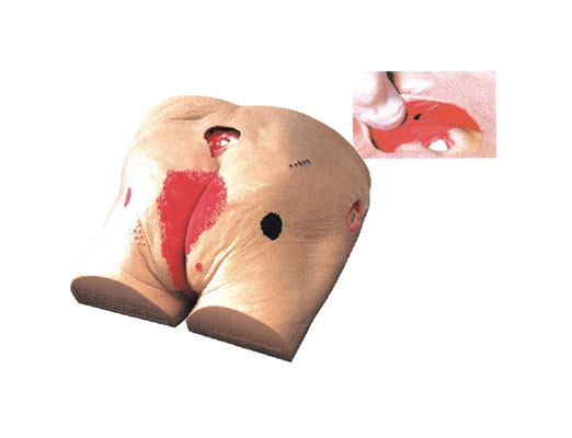 老年人褥瘡(壓瘡)護理模型?KAS-RC-2