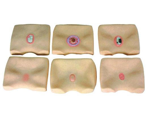 各期褥瘡護理模型?KAS/RC-6