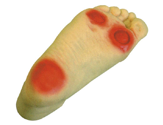 糖尿病足護理模型?KAS-HS19