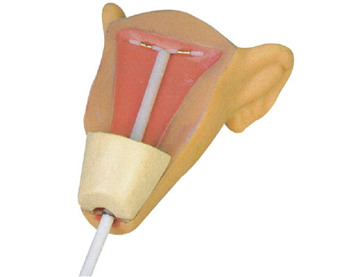 宮內避孕器訓練模型?KAS-B3-Ⅲ