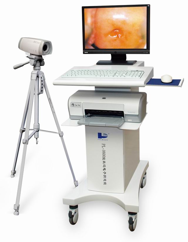 PL-9800 數碼電子陰道鏡