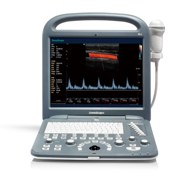S2N 全新彩色多普勒超聲診斷系統