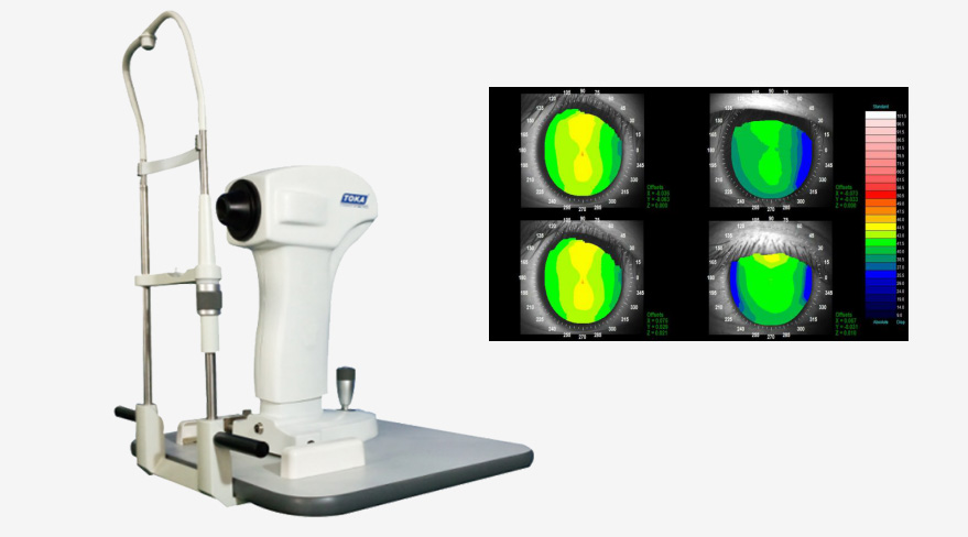 雷蒙光電角膜地形圖儀CT-6型 