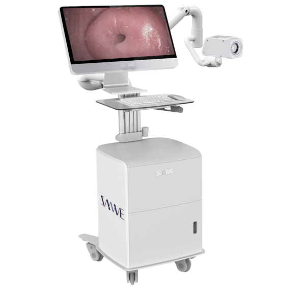 愛給力SW-3305 數字光學陰道鏡