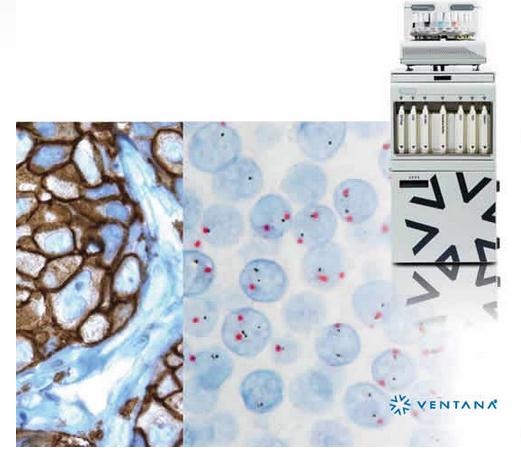 巴瑞自動染片機BenchMark GX