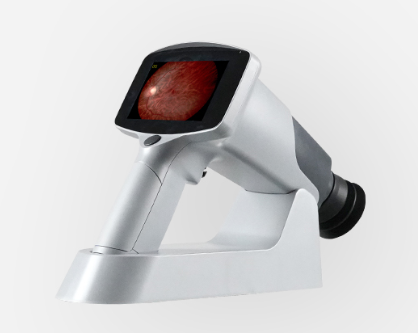 美沃手持式眼底照相機FC161