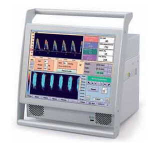 法國ATYS（阿迪斯）無創(chuàng)血液動力學監(jiān)護儀 WAKIe TO