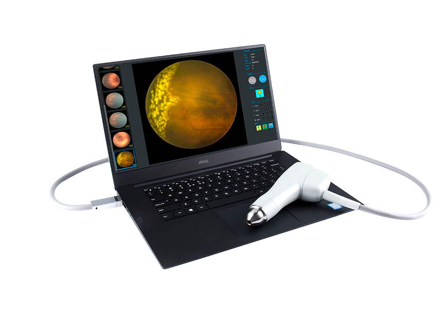 索維眼科廣域成像系統SW-8000P