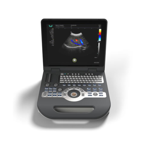 先鋒彩色多普勒超聲診斷系統(tǒng)XF-3600