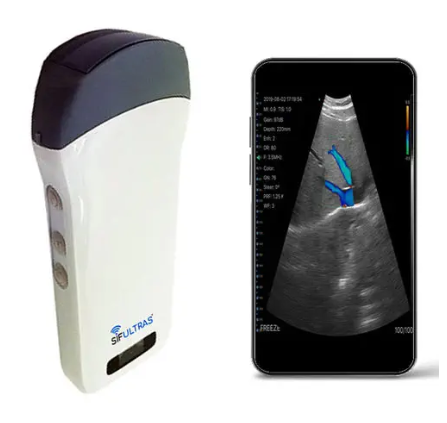 SIFSOF手持式B超機 SIFULTRAS-3.3
