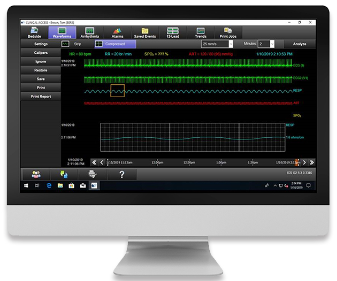 Xhibit*監(jiān)護(hù)站