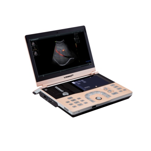 飛依諾便攜式數字化彩色超聲診斷儀VINNO 10