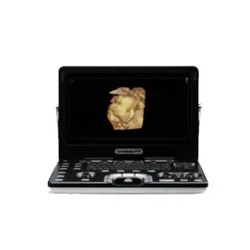 彩色超聲診斷儀 彩色超聲診斷儀