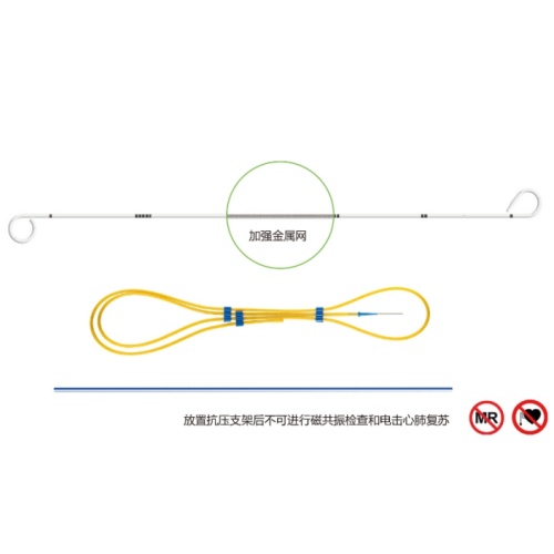 優(yōu)泰輸尿管支架（內(nèi)置金屬）