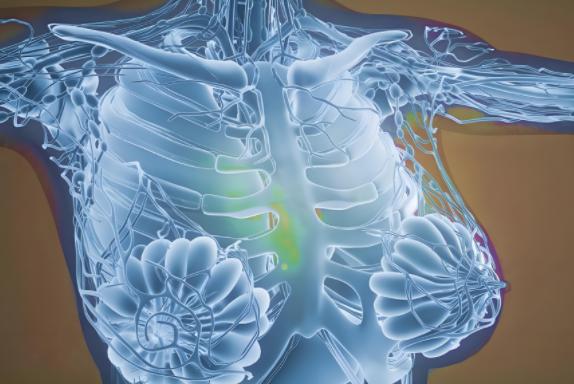 乳腺彈性成像準確嗎