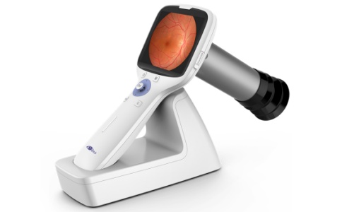 新眼光便攜眼底相機(jī)NES-1000P