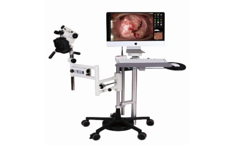 德國萊斯康陰道鏡