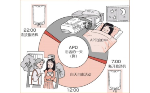 腹膜透析機(jī)