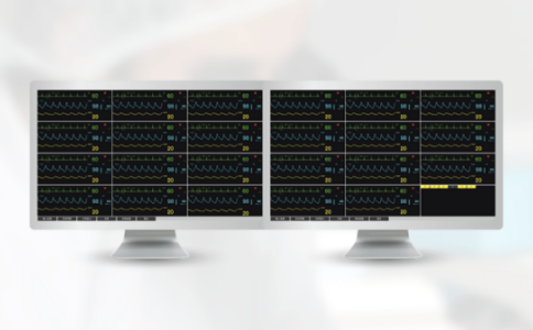 中央監(jiān)護系統(tǒng)