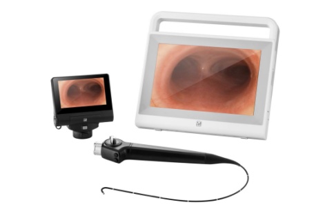 電子鼻咽喉鏡 電子鼻咽喉鏡