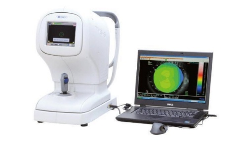 角膜地形圖 角膜地形圖