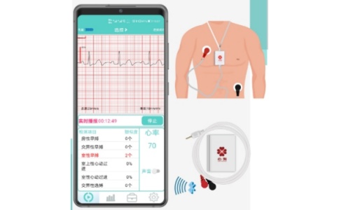心狗動態心電圖系統HWD系列